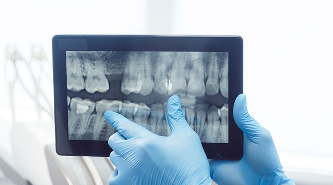 幅広い症例に対応