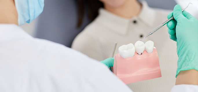 型取り・人工歯装着
